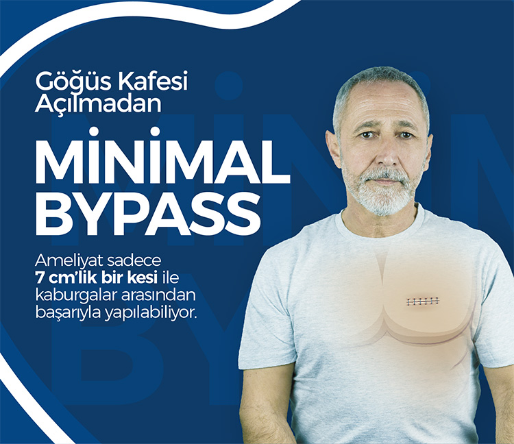 Minimal ByPass İle Göğüs Kemiğini Kesmeden Ameliyat